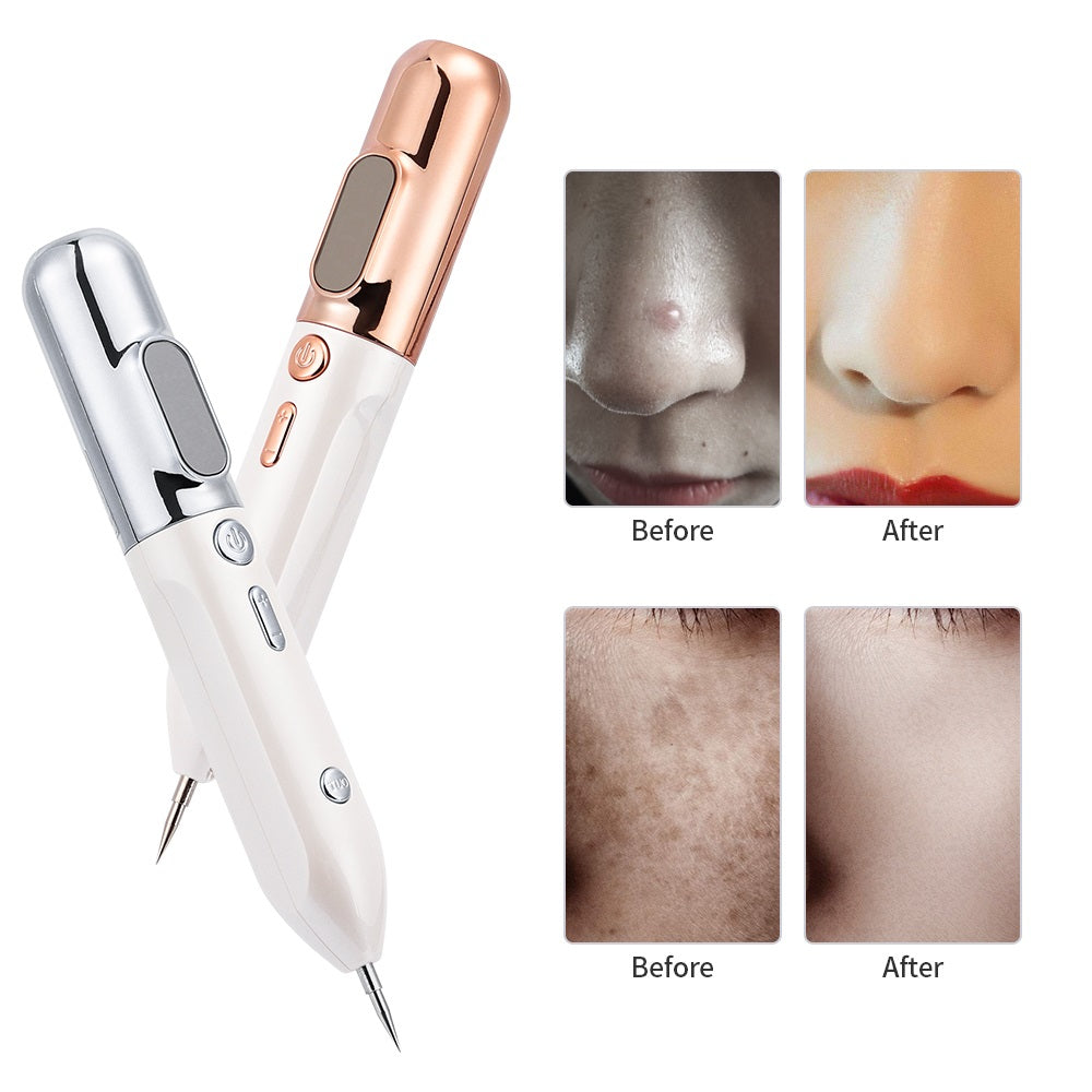 Plasma Huidverjongingspen - GlowLift