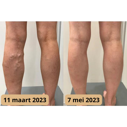 Voetmassage Mat - AcupressureFlow