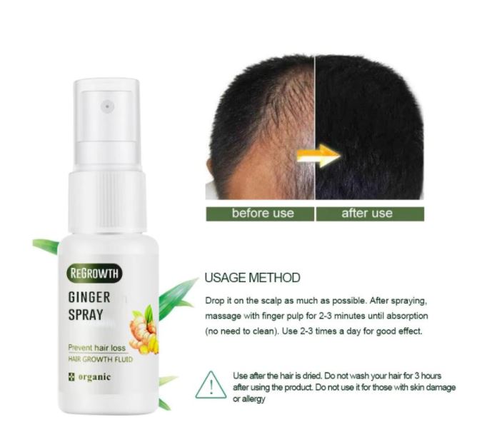 Hair Regrowth Ginger Spray™️ (1 + 1 GRATIS)