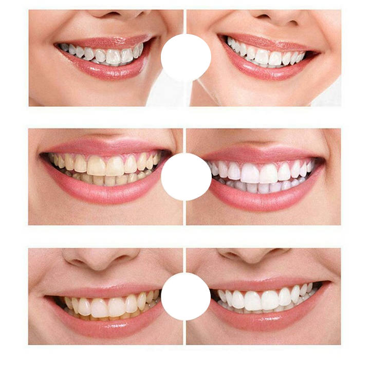 Instant Whitening Toothpaste™ (1+2 GRATIS)