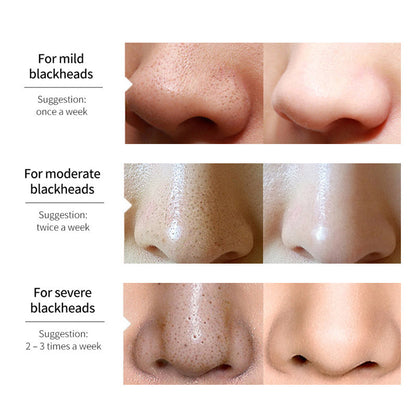 Lanbena Blackhead Remover™ (1+1 GRATIS)