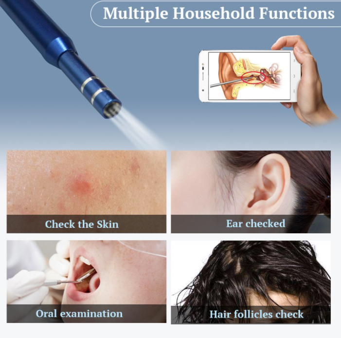 Ear Cleaning Endoscope™