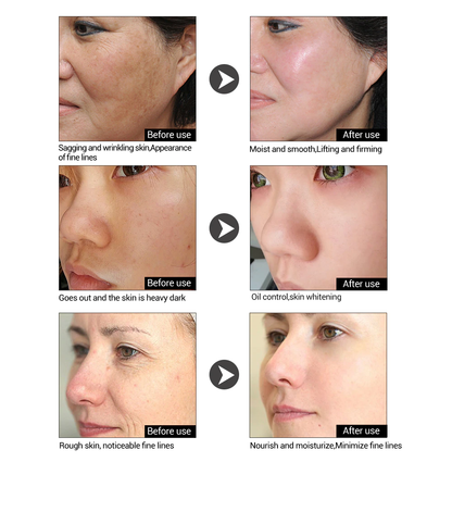 Lanbena Peptide Serum